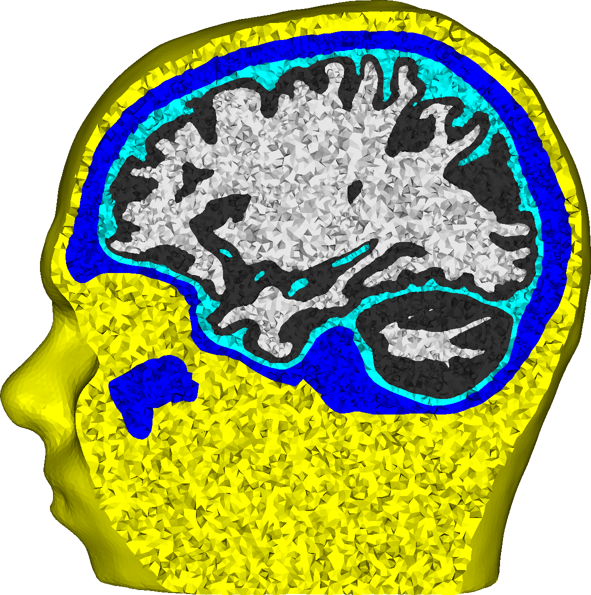 Realistic five compartment (skin, skull, CSF, gray matter, white matter) finite element head model